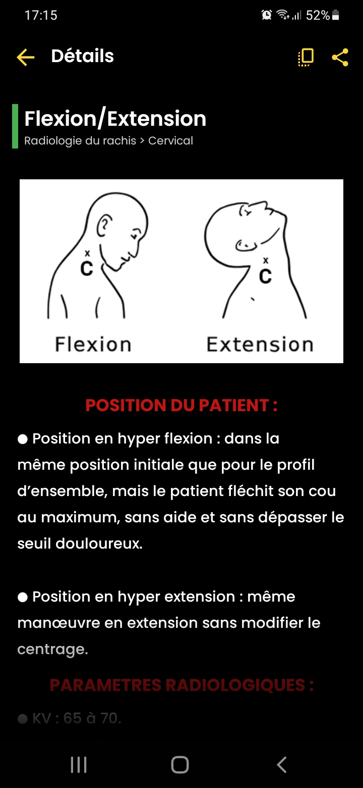 Fiches détaillées - Tek-Radiologie